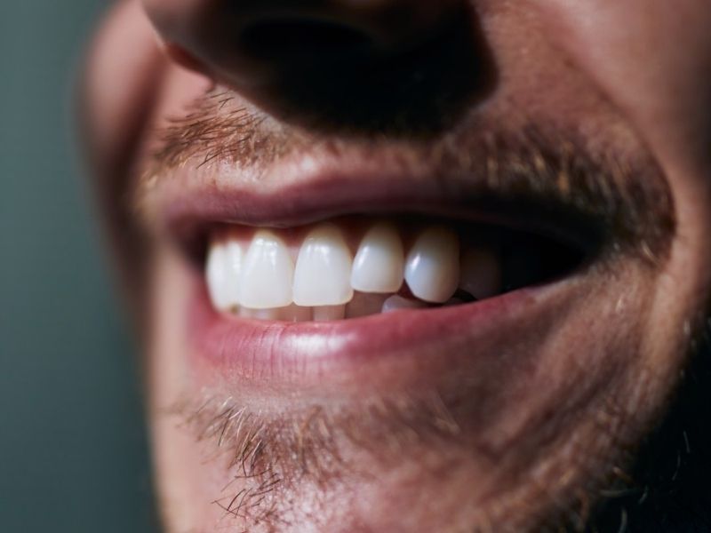 Sbiancare i denti in modo naturale: cosa fare e cosa evitare